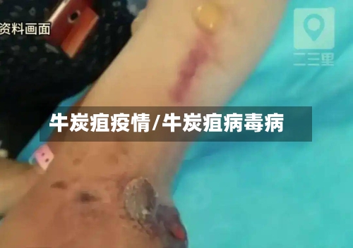 牛炭疽疫情/牛炭疽病毒病